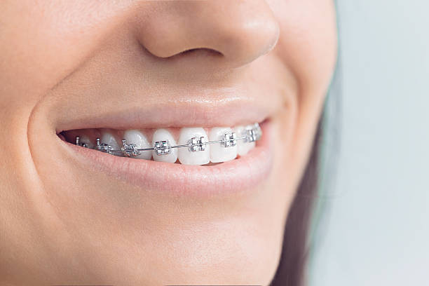 Best Invisalign and Clear Aligners  in Kerman, CA